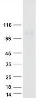 Human DTX2 Protein (Recombinant Myc-DDK (Flag))