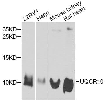 UQCR10 / UCRC Antibody