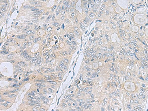 Polyclonal Rabbit anti-Human APOBR / APOB48R Antibody (IHC)