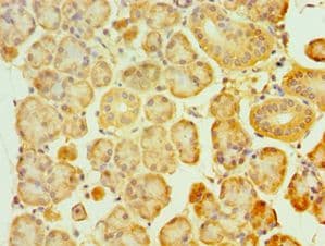 SIRT3 / Sirtuin 3 Antibody (aa20-130)
