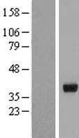 HSD17B2 Protein (Over-Expression Lysate Myc-DDK (Flag))
