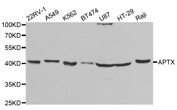 Polyclonal Rabbit anti-Human Aprataxin / APTX Antibody (IHC, IF, WB)