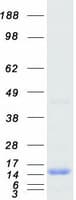 Human PTS Protein (Recombinant Myc-DDK (Flag))