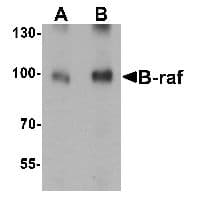 PathPlus™ BRAF / B-Raf Antibody