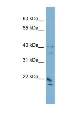DYDC1 Antibody (C-Terminus)
