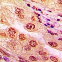 CAMK4 / CaMK IV Antibody (Internal)