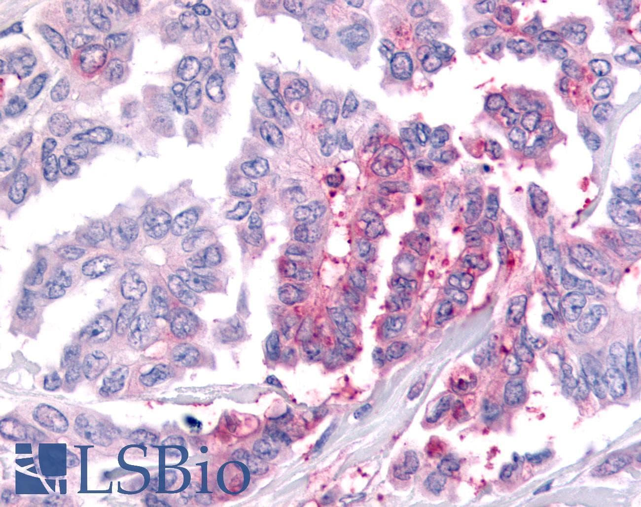 PathPlus™ WNK1 Antibody (C-Terminus)