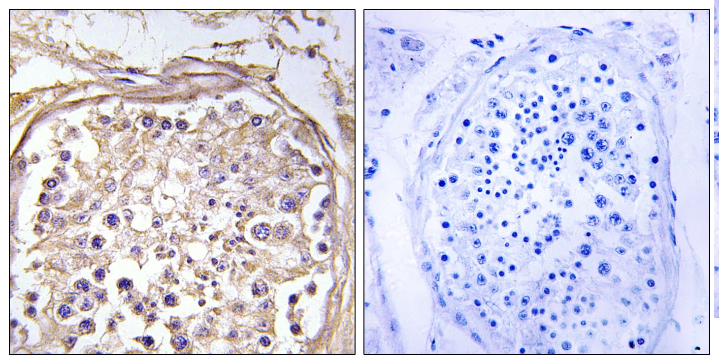 Polyclonal Rabbit anti-Human GALNAC4ST-2 / CHST9 Antibody (aa361-410, IHC, IF)