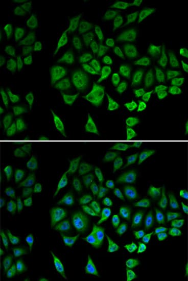 NDUFS1 Antibody