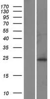 PDHX / Protein X / ProX (Over-Expression Lysate Myc-DDK (Flag))