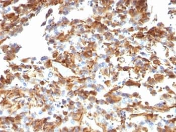 Vimentin Antibody (clone VM1170)