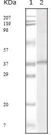 HHV-8 ORF62 Antibody (clone 5B7B6)