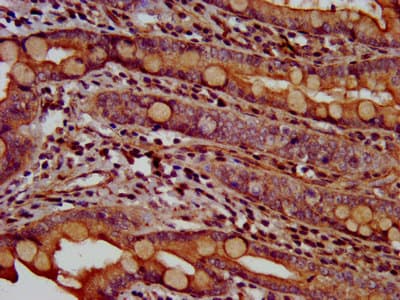 TMEM16B / ANO2 Antibody