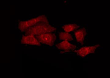 Polyclonal Rabbit anti-Human PRKY Antibody (IF, WB)