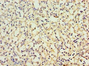 Polyclonal Rabbit anti-Human CBR3 Antibody (aa118-277, IHC, WB)