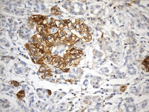 CD99 Antibody (clone UMAB262)