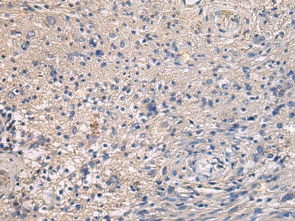 Polyclonal Rabbit anti-Human MAPKAPK3 Antibody (IHC)