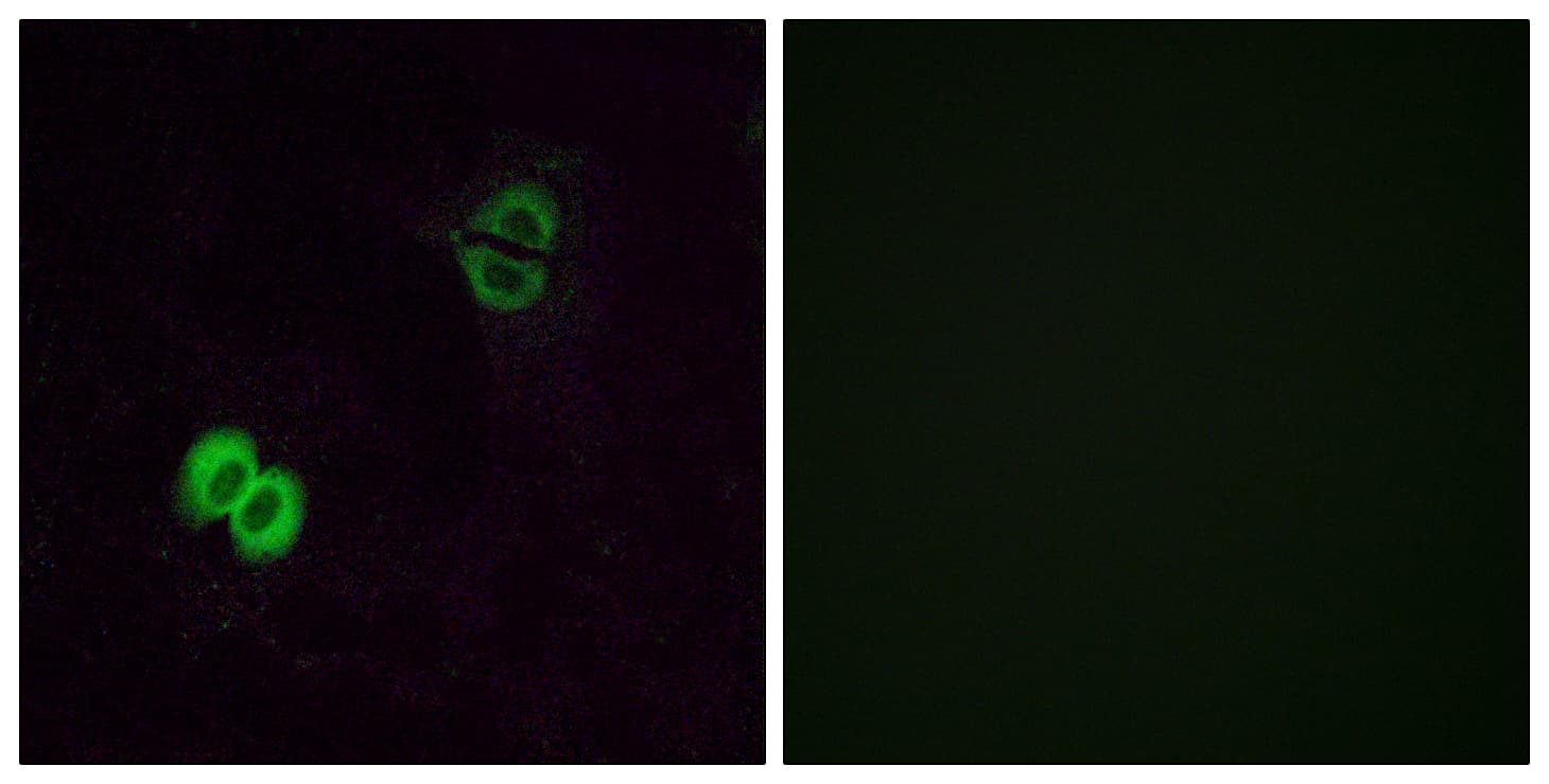 OR2T1 Antibody (aa231-280)
