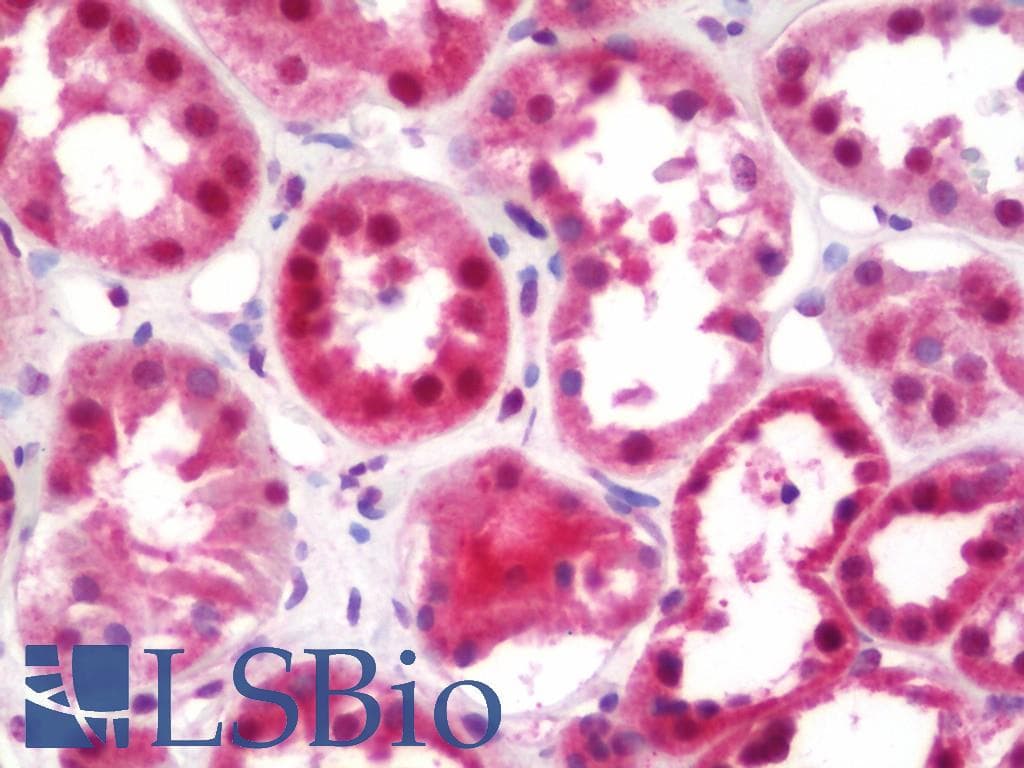 IHC-plus™ ABI1 / SSH3BP1 Antibody (aa325-375)