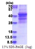 Human SPECC1 / CYTSB Protein (Recombinant His)