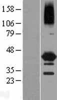 NEIL2 Protein (Over-Expression Lysate Myc-DDK (Flag))