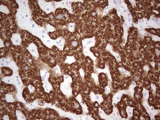 ABAT Antibody (aa29-323, clone OTI7E9)