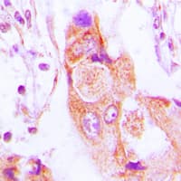AIM2 Antibody (Internal)