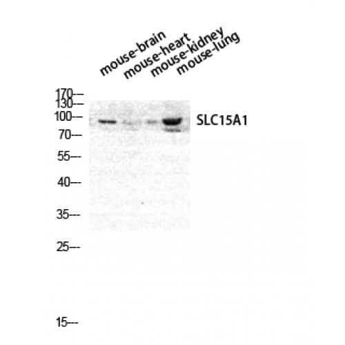 SLC15A1 / PEPT1 Antibody (200-280 aa, Internal)