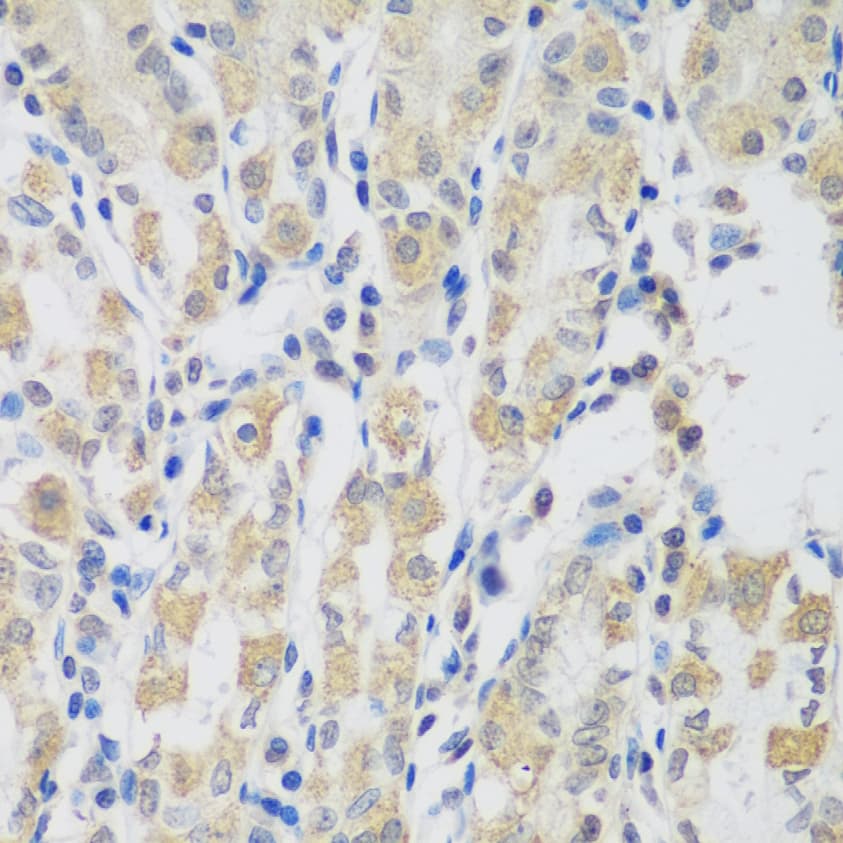 VPS4A Antibody