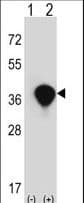 TALDO1 / Transaldolase 1 Antibody (aa186-215)