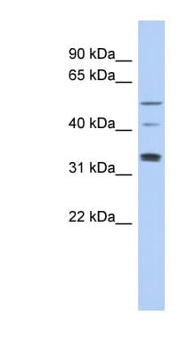 Polyclonal Rabbit anti-Human TCP11 Antibody (aa143-192, WB)