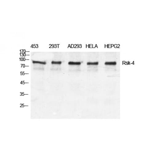 Polyclonal Rabbit anti-Human RPS6KA6 / RSK4 Antibody (630-710 aa, C-terminal, IHC, WB)
