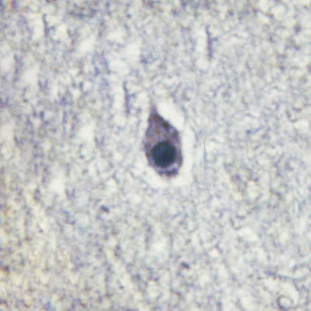 Polyclonal Rabbit anti-Human CALM3 / Calmodulin 3 Antibody (phospho-Thr79,phospho-Ser81, IHC, IF, WB)