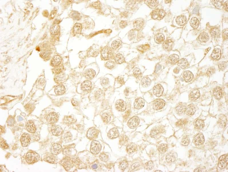 WDR20 Antibody (aa450-500)