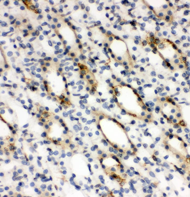 ARG2 / Arginase 2 Antibody (aa67-85)