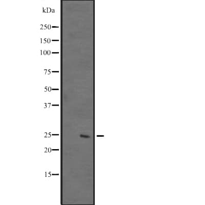 DUSP26 / MKP8 Antibody