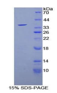 Mouse SIRT6 / Sirtuin 6 Protein (Recombinant His)