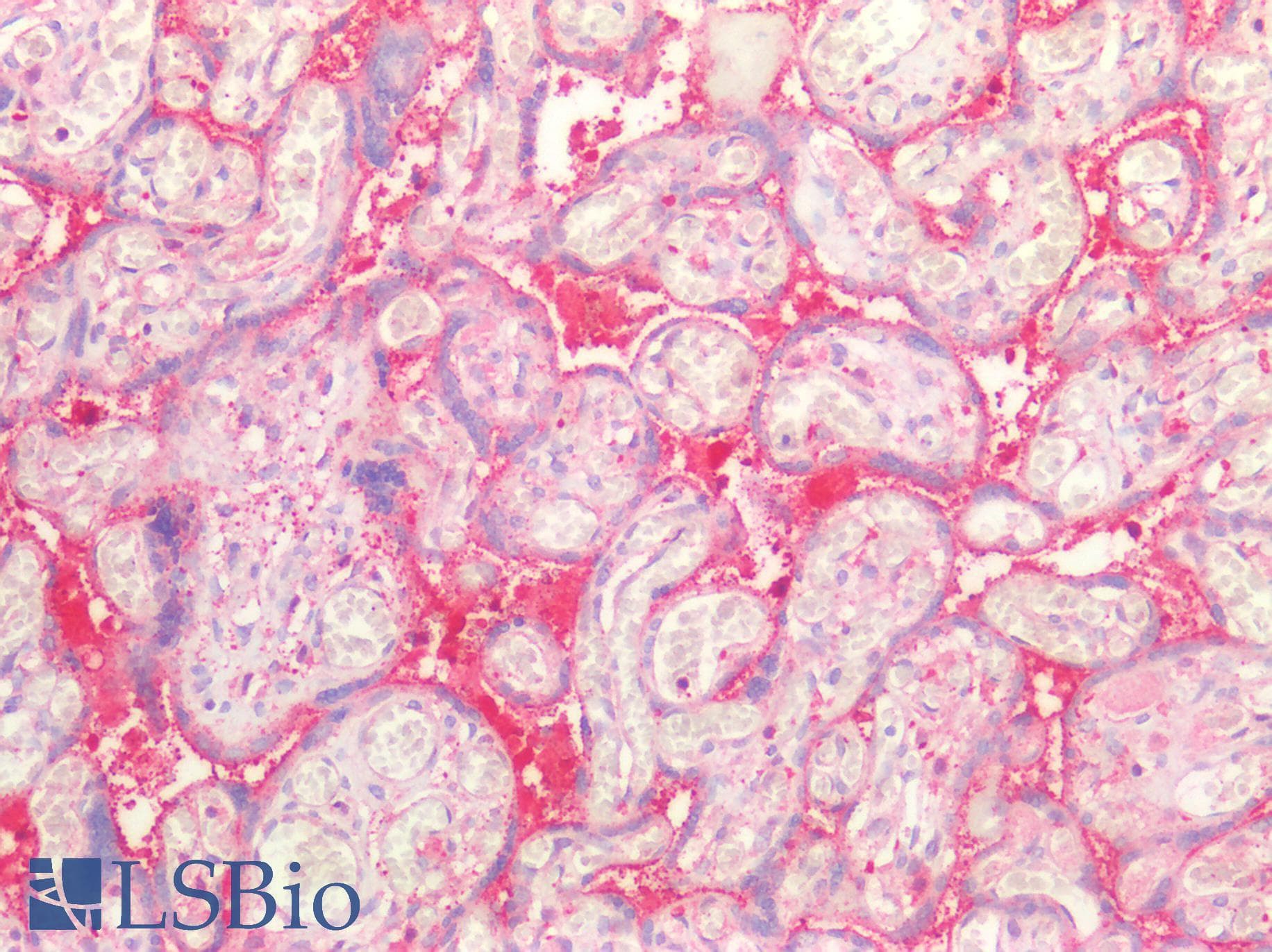 IHC-plus™ Polyclonal Rabbit anti-Human SDC1 / Syndecan 1 / CD138 Antibody (aa23-254, IHC, IF)