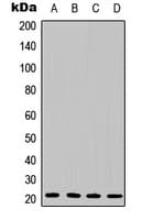 IL6 / Interleukin 6 Antibody (Internal)