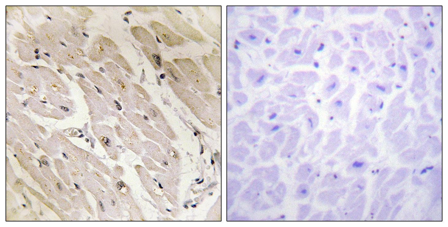 PRKAG2 / AMPK Gamma 2 Antibody