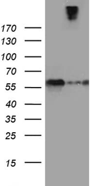 Monoclonal Mouse anti-Human SEMA3G / Semaphorin 3G Antibody (clone OTI8B9, aa569-782, WB)