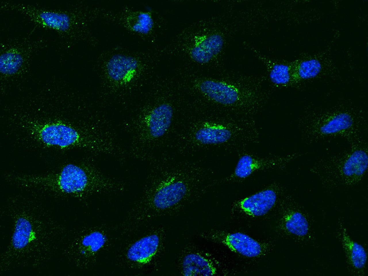 CCL2 / MCP1 Antibody (Preservative Free)