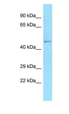 AMDHD2 Antibody (aa44-93)