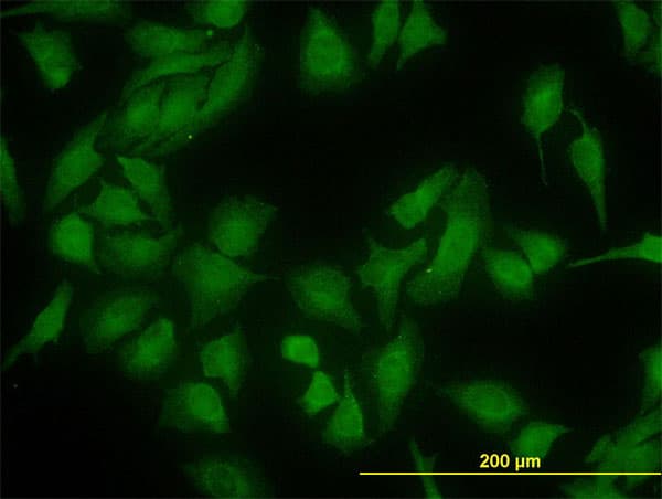 IHC-plus™ DNAJC10 Antibody (clone 3C4)