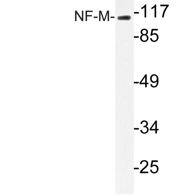 NEFM / NF-M Antibody (Lys591)