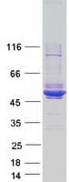 Human MAGEA4 Protein (Recombinant Myc-DDK (Flag))