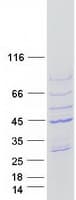 Human ARPM1 Protein (Recombinant Myc-DDK (Flag))