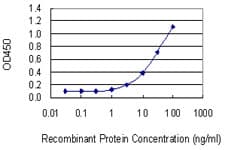 COMT Antibody (clone 1G4-1A1)