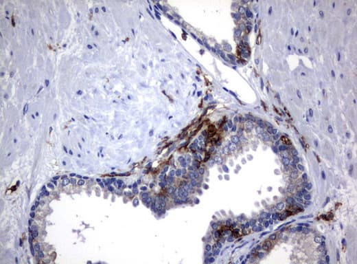 FCGR1A / CD64 Antibody (clone UMAB74, Carrier-free)