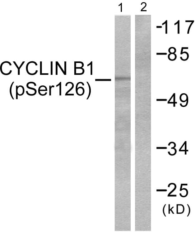 Polyclonal Rabbit anti-Human CCNB1 / Cyclin B1 Antibody (phospho-Ser126, IHC, WB)